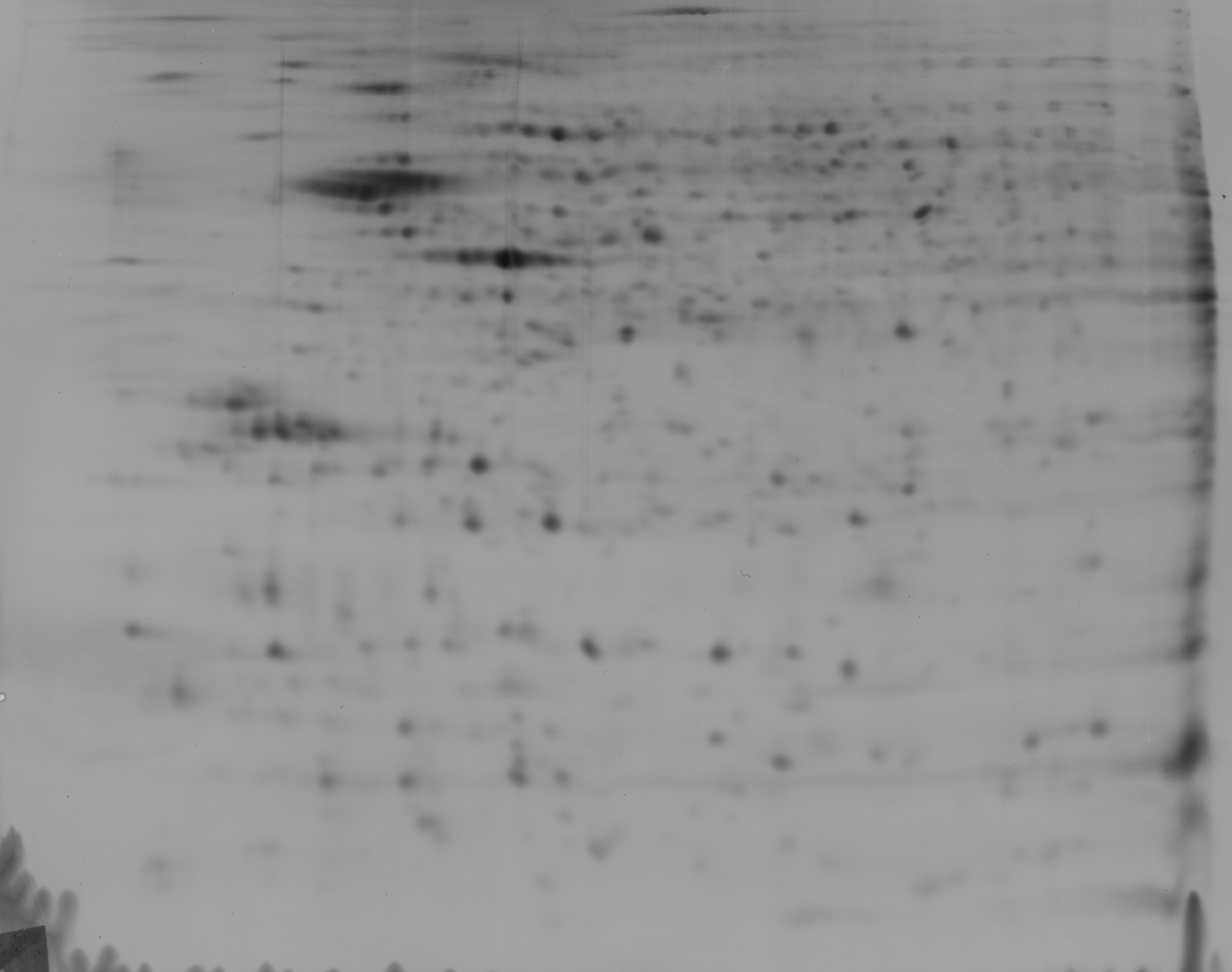 Photograph of a 2D gel electrophoresis result showing hundreds of dark protein spots scattered across the gel, separated by isoelectric point horizontally and molecular weight vertically