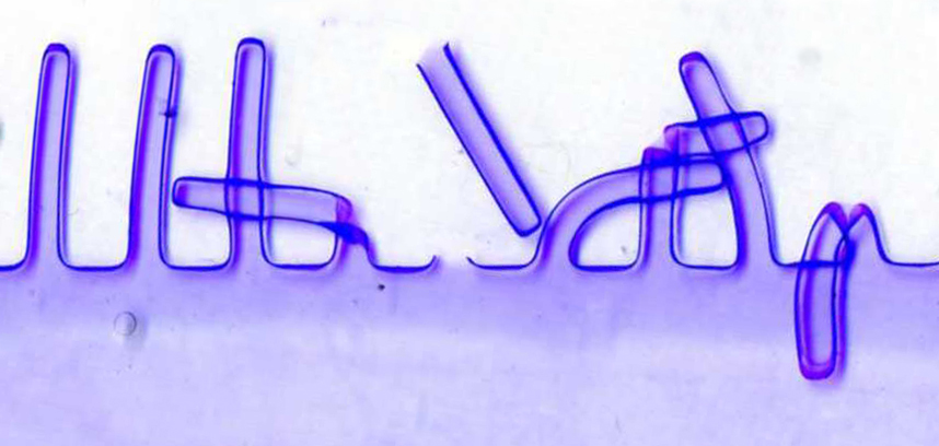Protein gel electrophoresis