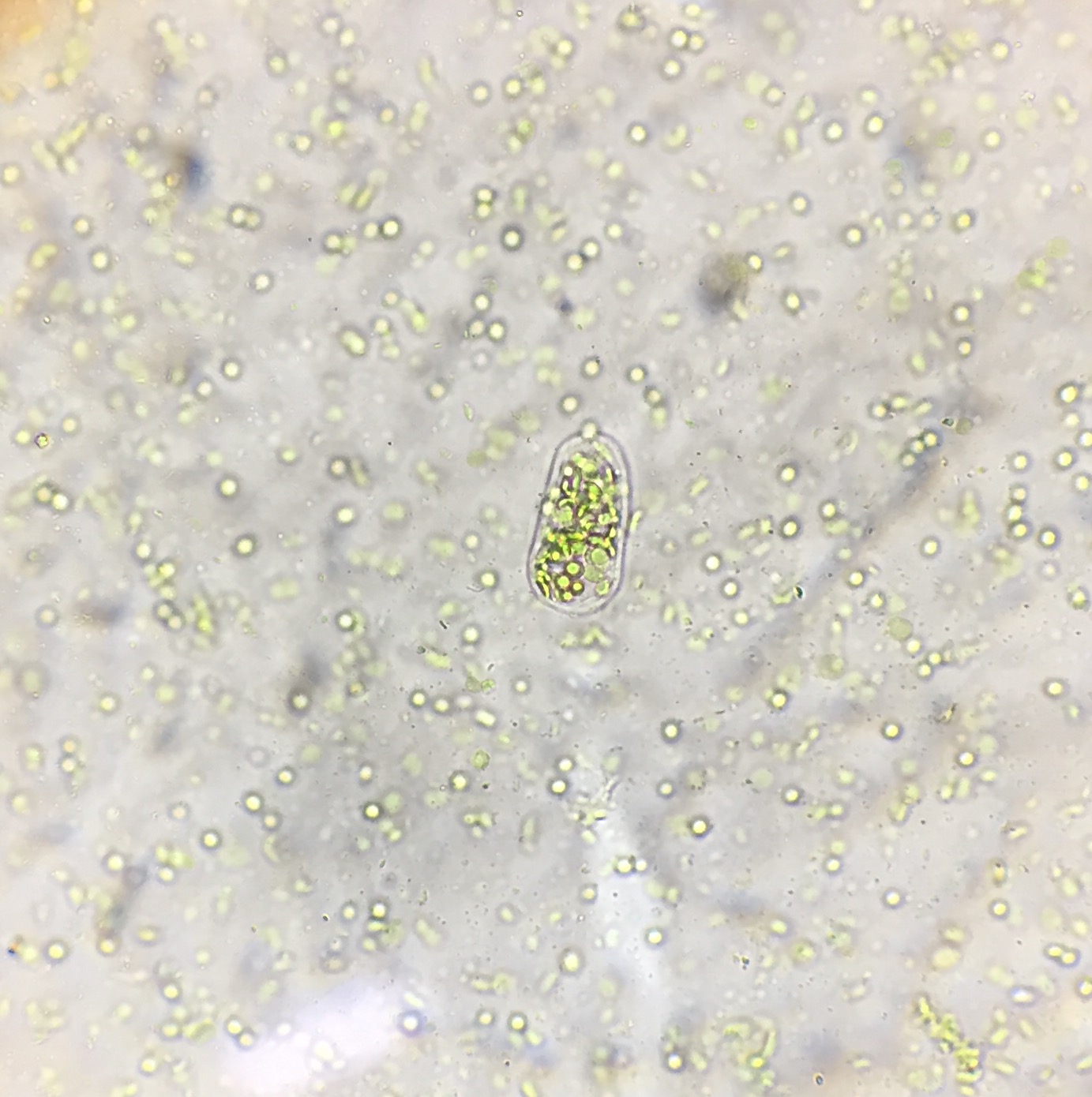 Isolated spinach chloroplasts