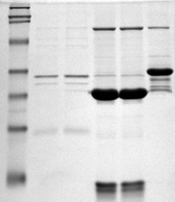 Photograph of an SDS-PAGE gel showing separated protein bands of different molecular weights stained with Coomassie blue